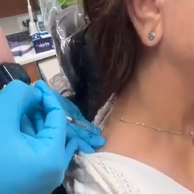 Trigger point injections2 copy3